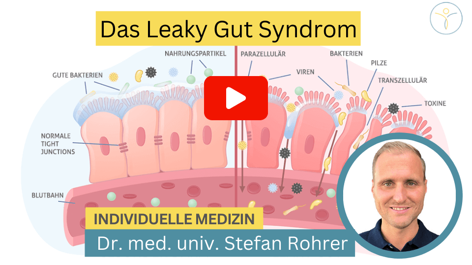 Video zum Leaky Gut Syndrom