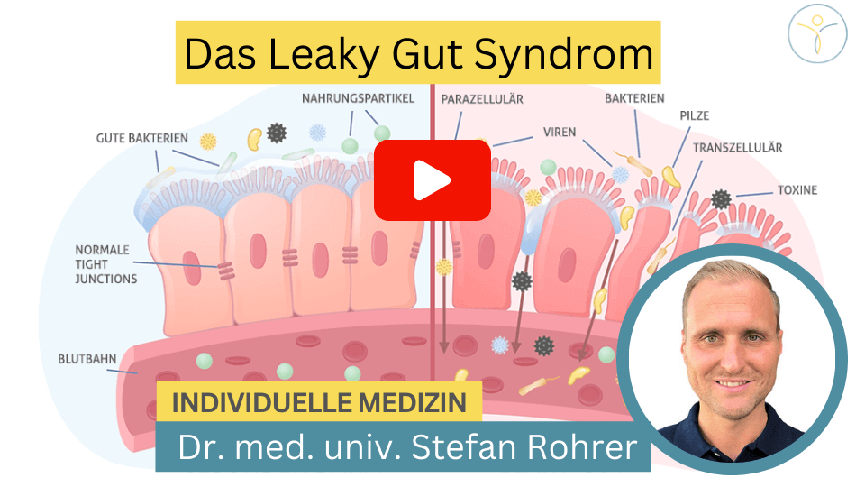 Video about Leaky Gut Syndrome